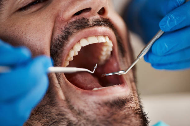 Best Emergency Dental Care for Sports Injuries in Swannanoa, NC